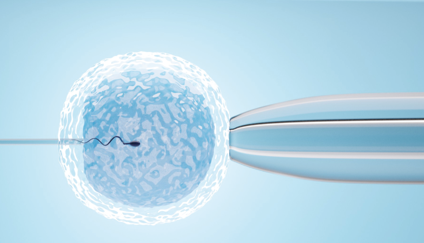 Tratamiento de fertilización in vitro